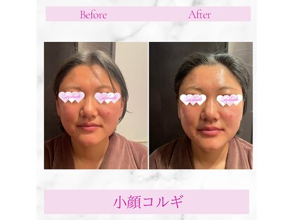 アフロディーテ 横浜(Aphrodite)の写真