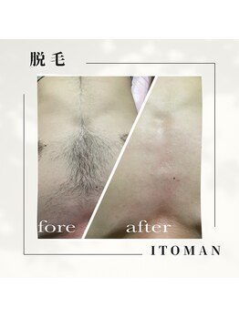 ジョエルワックス 沖縄糸満店(JOELLE WAX)/ムダ毛とさよなら!