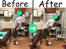 杉本接骨鍼灸院/腰痛・寝返りができなかった