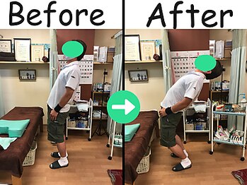 杉本接骨鍼灸院/腰痛・寝返りができなかった