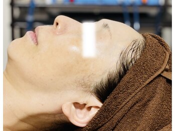 メディカルサロン かとれあ/お客様のお肌