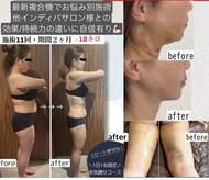 サロンドシェリ エステ(Salon de cheri)