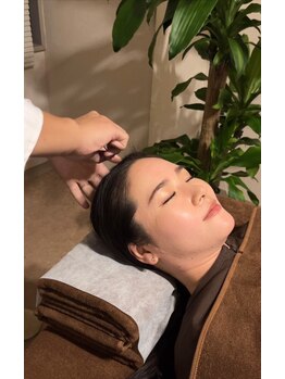 エクステンド鍼灸整体院(extend鍼灸整体院)/頭部の散らす鍼