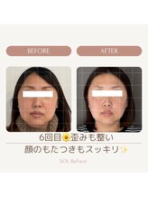 ソルビーフェイス(SOL*BeFace)/☆激変期！☆