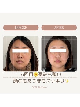 ソルビーフェイス(SOL*BeFace)/☆激変期!☆