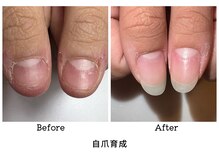 アンベリール(embellir.)/自爪育成　ネイルケア