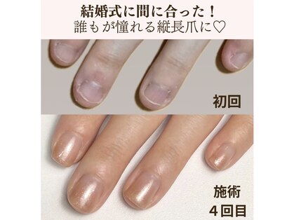 ポノポ(ponopo)の写真