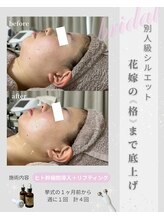 シイ(total skin beaute sii)/20代　リフティング　週1×４回