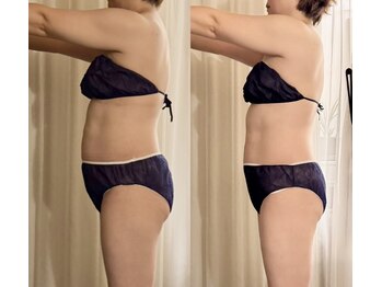 サロン ド プリヴェ(Salon de PRIVE)/40代50代限定フォルム形成プラン