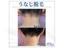デール(R:DeeL)の雰囲気（うなじ脱毛はブライダルにはかかせない！より自然に形を整えます）