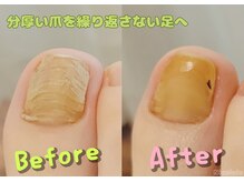 ニコルル 高崎店(Nicolulu)/分厚い爪！伸びにくい爪も！
