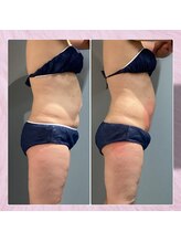 プリマプリート 可児店/１回でマイナス3ｃｍ？！