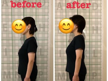 アンムート(anmut)/慢性的な肩こり・頭痛でお悩み!