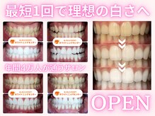 ホワイトニングセンター 愛知刈谷