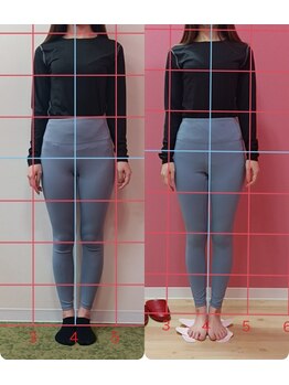 骨盤ダイエット専門サロン【骨盤ちゃん】ガーデン前橋店/Before/After/足の長さ