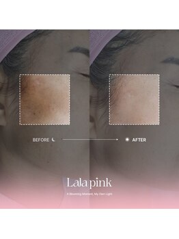 カルム(Calme)/Lalapink