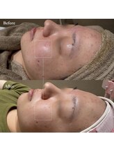 韓美(KANBI)/韓国肌管理Before After