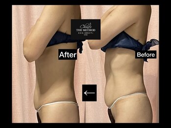 サザンベル 石垣店(SOUTHERN BELLE)/ぽっこりお腹にも★美骨矯正