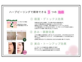 ブレスユー 北堀江(bless you)/オーロラ・ハーブピーリング