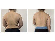 アンリ(Anli)/当店一人気!大滝汗