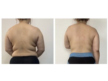 アンリ(Anli)/当店一人気!大滝汗