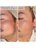 メンズ【再来】フェイスWAXパック付　￥14,000