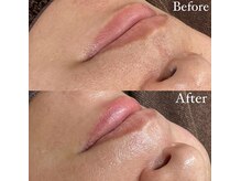 シェリ(Cheri)/フェイスワックス