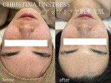 クリスティーナアンストレス/毛穴/くすみ/フェイシャル/小顔