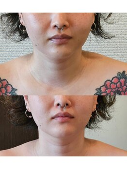 金梨花サロン/顔全体的なむくみ改善
