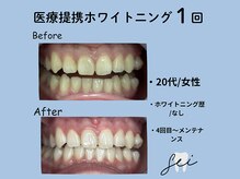 セイ(sei)/症例写真　ビフォーアフター