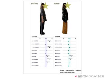 サロンラグナ(Salon Laguna)/お客様例：姿勢の変化