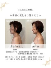 ウィズリリナ 新横浜(with Lilina.)/フェイスラインや左右差姿勢まで