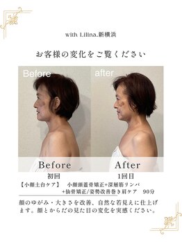 ウィズリリナ 新横浜(with Lilina.)/フェイスラインや左右差姿勢まで