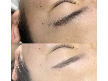 ラニ(Lani)/女性も男性も♪フェイシャルWAX