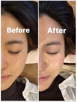 施術所ひびき庵/フェイシャルエステ