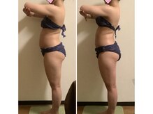 カレンの雰囲気（筋膜リリースまず集中5回結果出る！痩身・肩こり・美脚・むくみ）