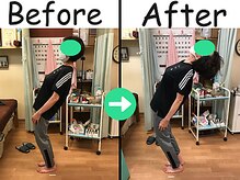 杉本接骨鍼灸院/2980円のモミ屋さんでは全く