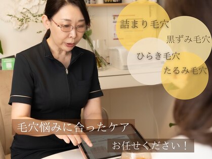 アンヘル(Angel)の写真
