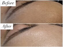 ムゥ(Mwoo)/フェイシャルワックス/顔脱毛