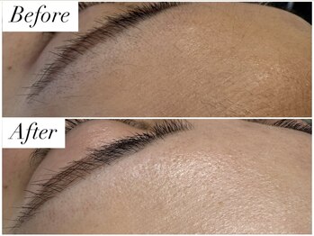 ムゥ(Mwoo)/フェイシャルワックス/顔脱毛