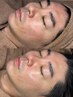 根本改善！小顔＆美肌リセットコース(5回)肌・首・肩・ヘッド【ララピール】