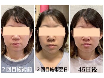 クリーム 京都店(Cream)/