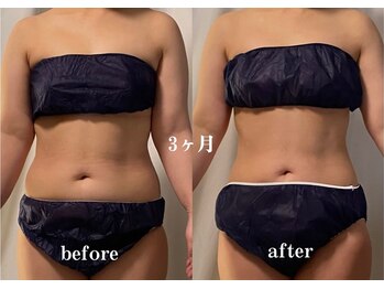 ダンデライオン 天神南店(dandelion)/3ヶ月で人生を変える痩身エステ