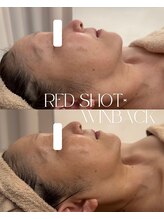 さかうえ接骨院/レッドショット×WINBACK