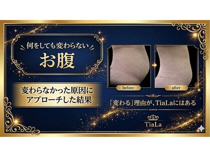 メンズアンドレディース エステティックサロン ティアラ(TiaLa)の写真