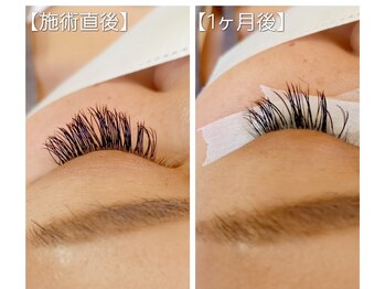 アイ シャイン(eye shine)/1ヶ月後もバラつきにくい◎LED