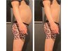 【男性限定☆】慢性疲労・肩こり・お腹引締め◎マシン×リンパ筋膜リペア60分