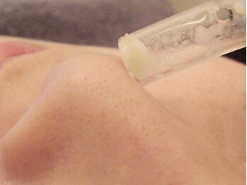 ジ．インペリアル 金山駅店(G.IMPERIAL)/【小顔コース】4.毛穴吸引