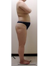 ジョイア 本店(Beauty＆Detox gioia)/安曇野市30代のお客様ビフォー