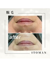 ジョエルワックス 沖縄糸満店(JOELLE WAX)/フェイスWAXで産毛もゴッソリ♪